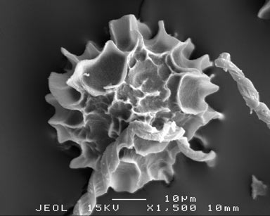 APII jpeg image of Fossombronia wattsii  © contact APII