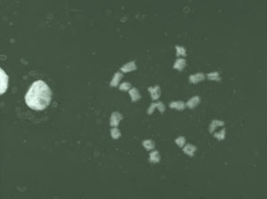 Chromosomal studies in Viscum